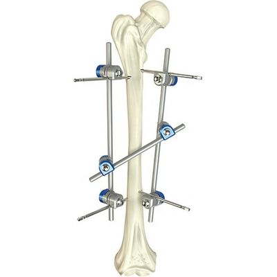 El instrumento ortopédico básico fijó el dispositivo de fijación externo del eje femoral quirúrgico