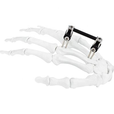 Dispositivo quirúrgico ortopédico de Mini Fragment Ilizarov External Fixation