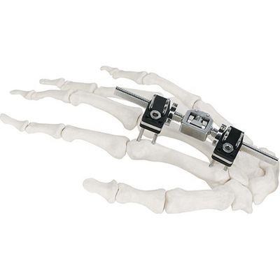 Dispositivo quirúrgico ortopédico de Mini Fragment Ilizarov External Fixation