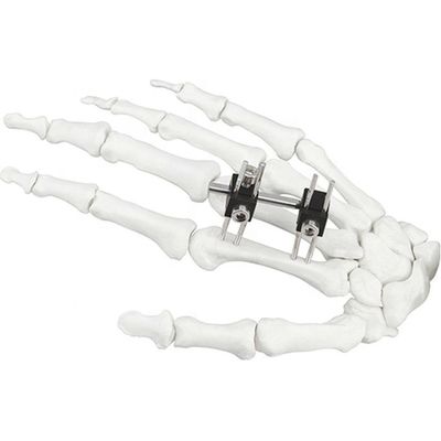 Dispositivo quirúrgico ortopédico de Mini Fragment Ilizarov External Fixation