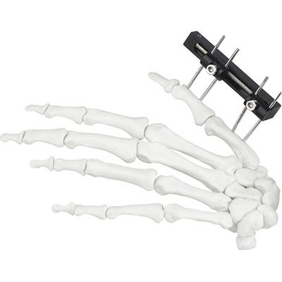 Dispositivo quirúrgico ortopédico de Mini Fragment Ilizarov External Fixation