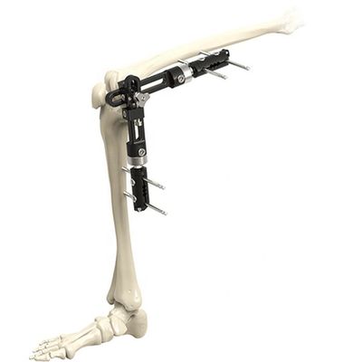 Fijación externa externa ortopédica de alta calidad Instrumen quirúrgico ortopédico de Fixator de la junta de rodilla de los instrumentos quirúrgicos