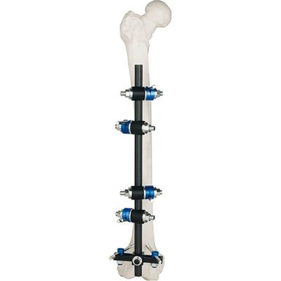 Fémur Fixator externo tibial