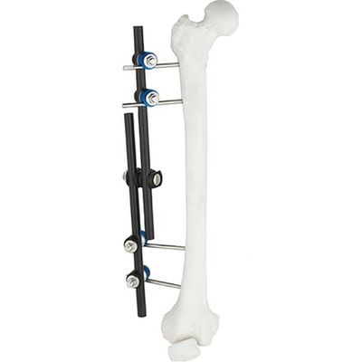 Instrumentos quirúrgicos ortopédicos de la venta caliente tibiales y instrumento ortopédico de la fijación externa de Fixator AO del externo del fémur