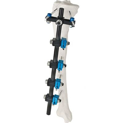 Implante ortopédico de los instrumentos quirúrgicos del precio de fábrica de la fijación externa externa tibial ortopédica de Fixator AO