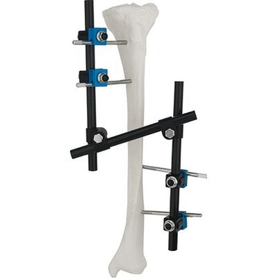 Instrumentos quirúrgicos ortopédicos de alta calidad tibiales y implante ortopédico de la fijación externa de Fixator AO del externo del fémur