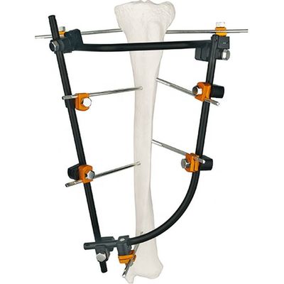Sistema médico del titanio de la calidad de los instrumentos quirúrgicos de Fixator del instrumento de los instrumentos externos ortopédicos excelentes del sistema-III