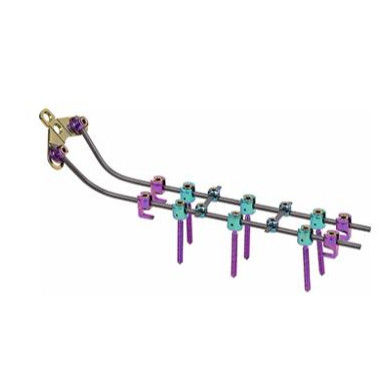 Los tornillos cervicales posteriores del sistema de Vertebar Roces insertan el dispositivo de fijación de la espina dorsal