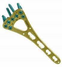 Fijación distal de la placa de la fractura de la clavícula de Accumed de la clavícula del gancho del hombro