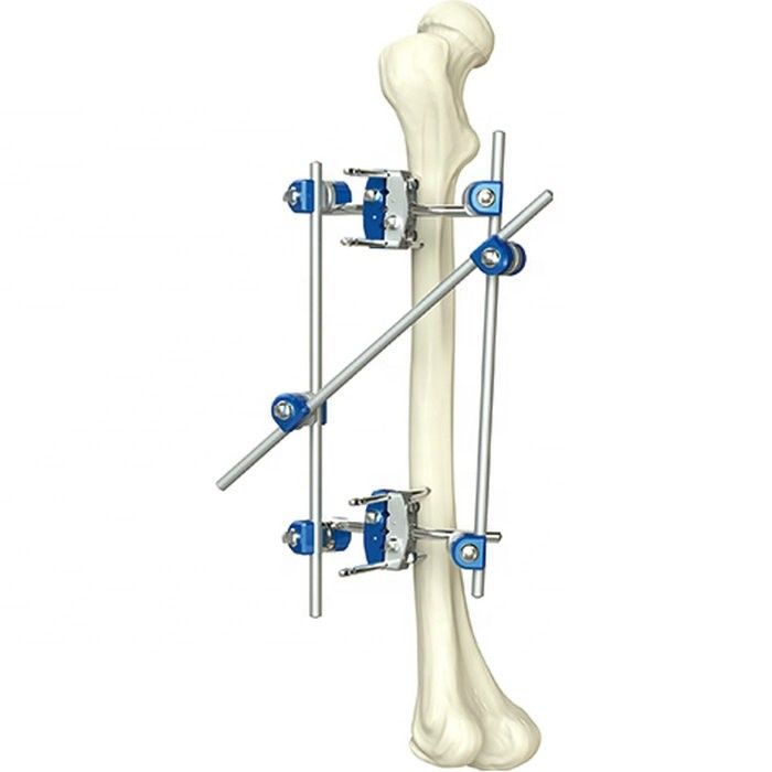 Tibia ortopédica del instrumento excelente de la calidad y instrumentos quirúrgicos ortopédicos de Fixator del externo de Percone