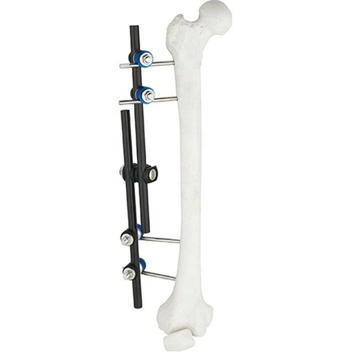 Instrumentos quirúrgicos ortopédicos de la venta caliente tibiales y instrumento ortopédico de la fijación externa de Fixator AO del externo del fémur