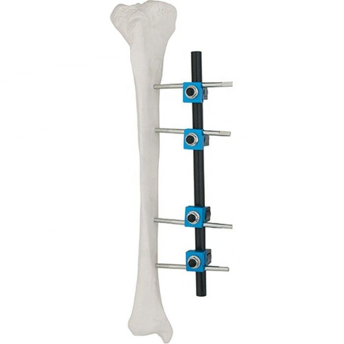 La calidad aseguró el implante ortopédico de los instrumentos quirúrgicos de la fijación externa externa tibial ortopédica de Fixator AO
